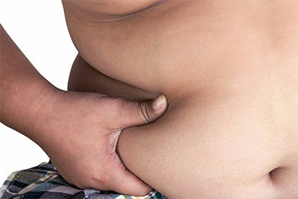 WHO calls for curbs on marketing to tackle obesity